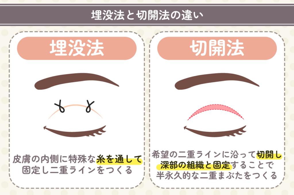 埋没法と切開法の違いは?特徴と費用相場を解説