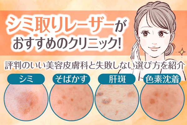 シミ取りがおすすめのクリニック20選！評判のいい美容皮膚科と失敗しない選び方を紹介