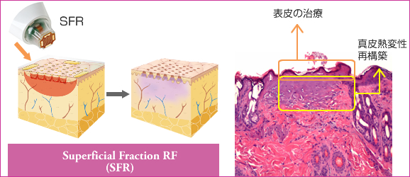 CtBjSFR}1